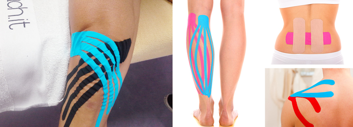 Taping, l’applicazione  di un nastro adesivo ed elastico,